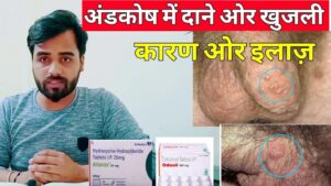 अंडकोष पर फोड़े फुंसी,सफेद दाने,खुजली का इलाज || Testicle Boils,Itching Treatment- Medical jankari