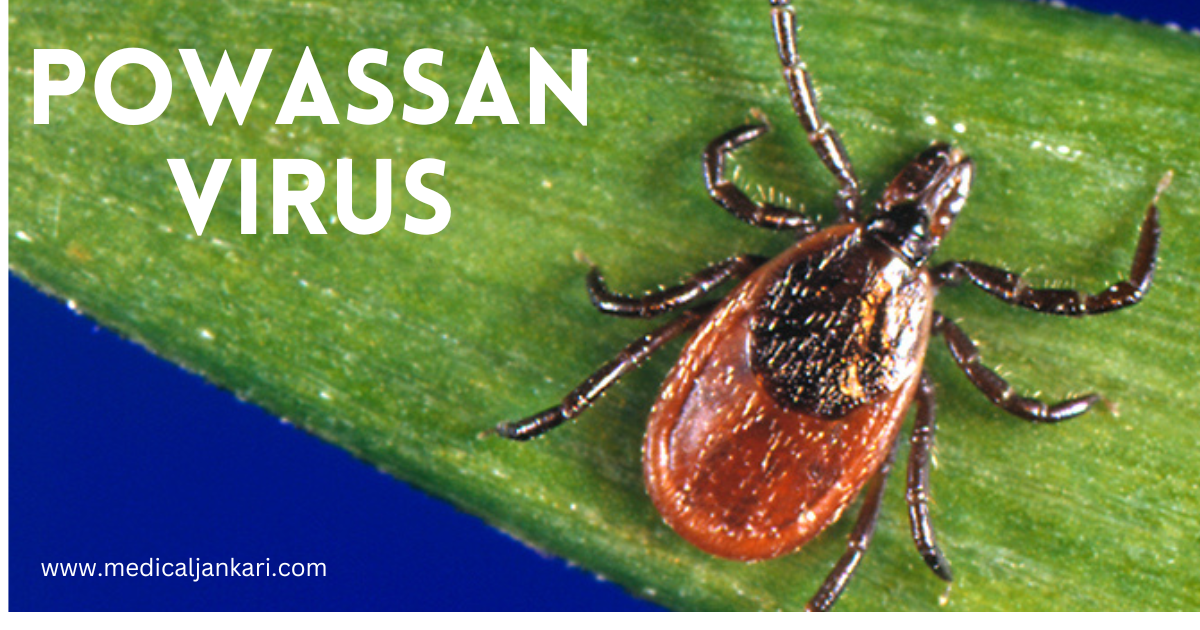 Powassan Virus